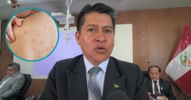 UGEL Sur implementa protocolos sanitarios contra sarampión UGEL Sur implementa protocolos sanitarios contra sarampión
